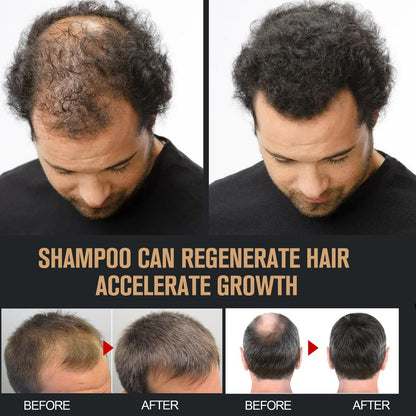2 Pcs Root Activator Shampoo - Hair Growth Shampoo for Anti-Hair Loss, Natural Formula for Men and Women Avelisse
