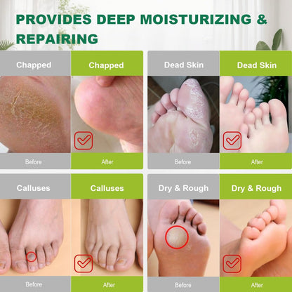 300PCS Disposable Foot Covers for Feet Moisturizer Socks - Extra Large Plastic Foot Covers for Pedicure, Moisturizing & Paraffin Wax Treatments, Spa Socks Designed for Foot Care