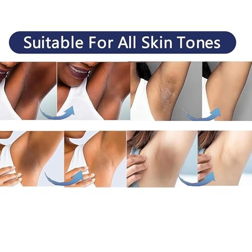 Intimate Areas Skin Lightening Cream for Private Parts, Underarm, Bikini Area, Inner Thighs, Knees, Elbows – Gentle Bleaching & Whitening Cream for Body Avelisse