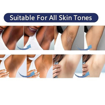 Intimate Areas Skin Lightening Cream for Private Parts, Underarm, Bikini Area, Inner Thighs, Knees, Elbows – Gentle Bleaching & Whitening Cream for Body Avelisse