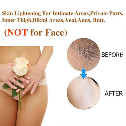 Intimate Areas Skin Lightening Cream for Private Parts, Underarm, Bikini Area, Inner Thighs, Knees, Elbows – Gentle Bleaching & Whitening Cream for Body Avelisse