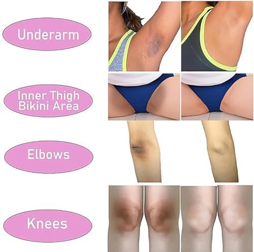 Intimate Areas Skin Lightening Cream for Private Parts, Underarm, Bikini Area, Inner Thighs, Knees, Elbows – Gentle Bleaching & Whitening Cream for Body Avelisse