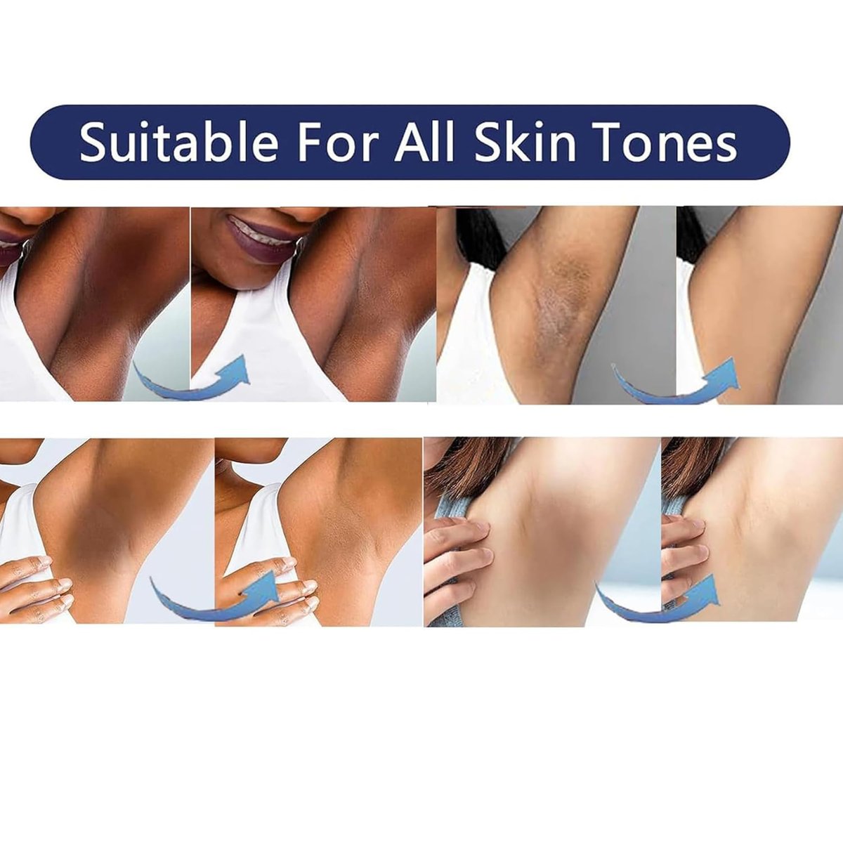 Intimate Areas Skin Lightening Cream for Private Parts, Underarm, Bikini Area, Inner Thighs, Knees, Elbows – Gentle Bleaching & Whitening Cream for Body Avelisse