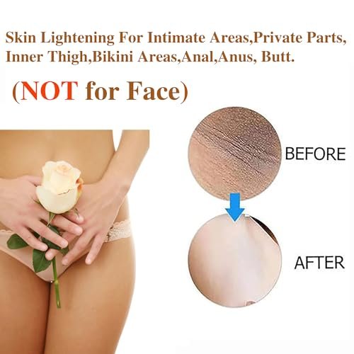Intimate Areas Skin Lightening Cream for Private Parts, Underarm, Bikini Area, Inner Thighs, Knees, Elbows – Gentle Bleaching & Whitening Cream for Body Avelisse