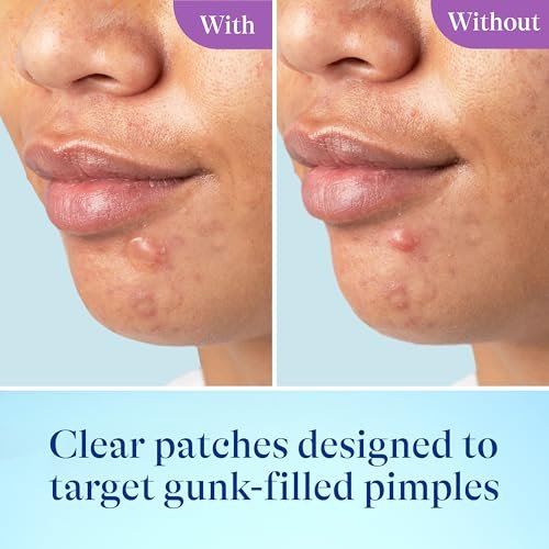 Differin Power Patches for White Head Pimples, Hydrocolloid Patches with Zinc Hyaluronate & Niacinamide, 4-in-1 Hydrotech™ Formula, 23 Count - görsel 10