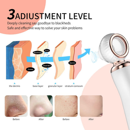 2025 Blackhead Remover Pore Vacuum - Visual Rechargeable Facial Pore Cleaner with 3 Suction Silicone Heads, 3 Probes, USB Kit - Electric Acne Extractor Tool for Adults, White