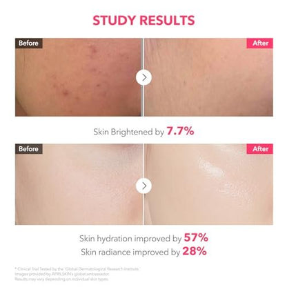 APRILSKIN TXA Pink Capsule Gel Mask - Overnight Face Mask for Glass Glow Skin with 99% High-Purity Tranexamic Acid, Hydrating and Firming, Korean Skincare, 30g x 4ea