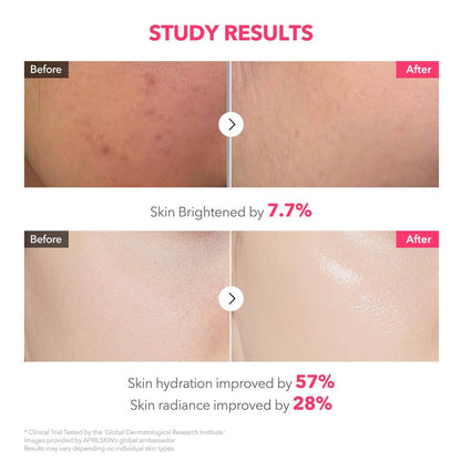 APRILSKIN TXA Pink Capsule Gel Mask - Overnight Face Mask for Glass Glow Skin with 99% High-Purity Tranexamic Acid, Hydrating and Firming, Korean Skincare, 30g x 4ea