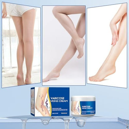 Wanban Varicose Veins Treatment Cream for Legs – Natural Ingredients, Suitable for Most Skin Types Avelisse