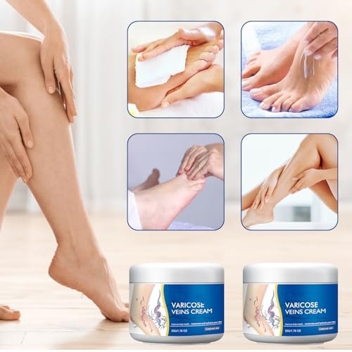 Wanban Varicose Veins Treatment Cream for Legs – Natural Ingredients, Suitable for Most Skin Types Avelisse