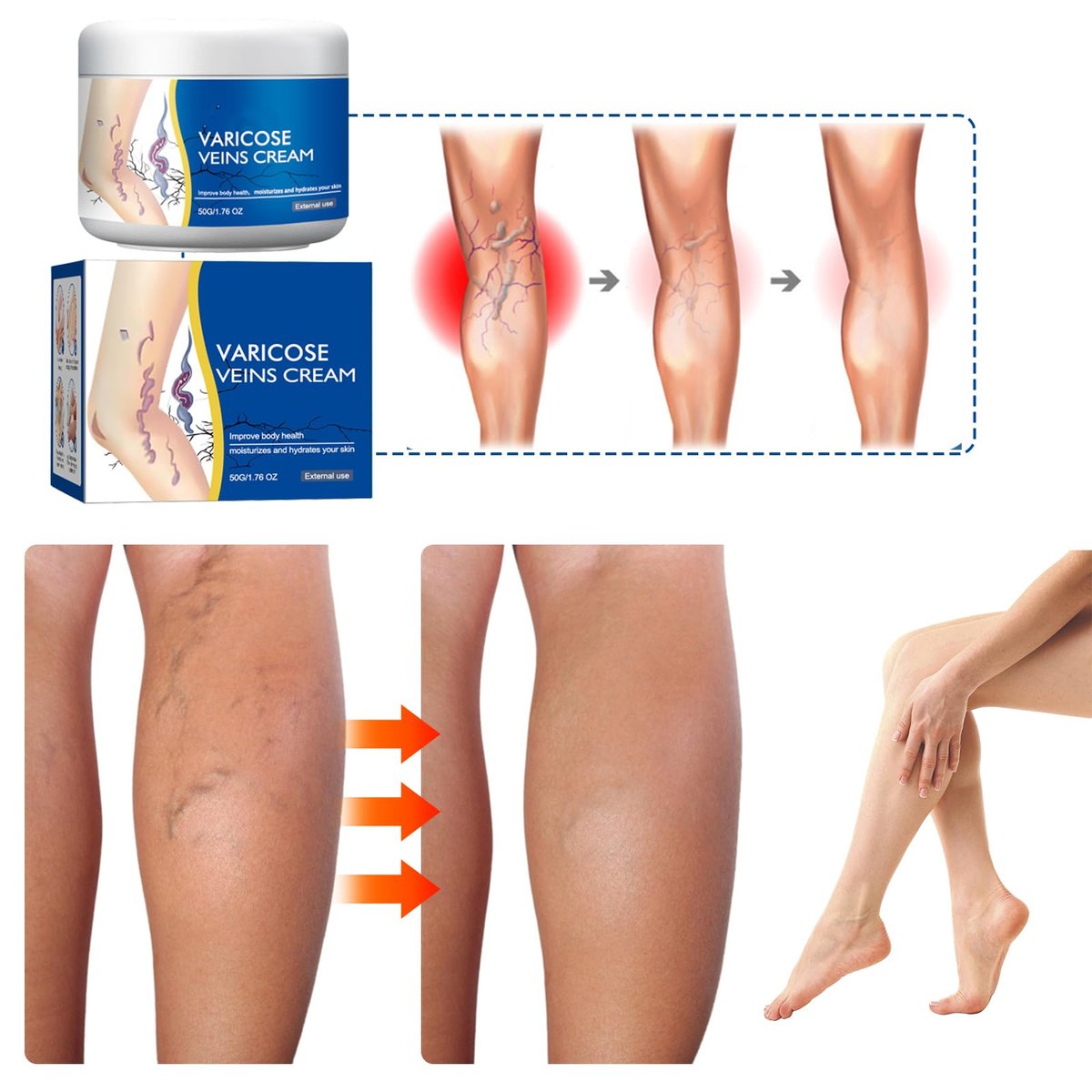 Wanban Varicose Veins Treatment Cream for Legs – Natural Ingredients, Suitable for Most Skin Types Avelisse