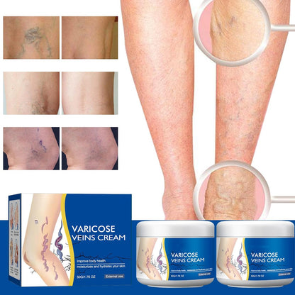 Wanban Varicose Veins Treatment Cream for Legs – Natural Ingredients, Suitable for Most Skin Types Avelisse