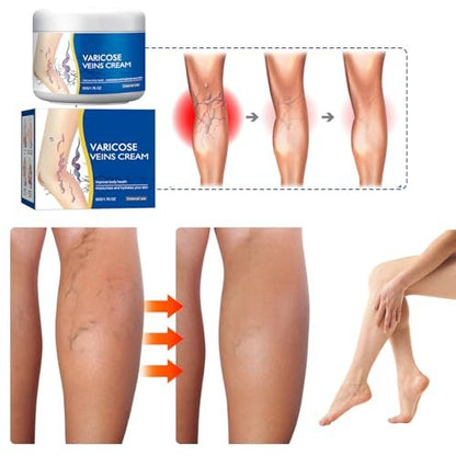 Wanban Varicose Veins Treatment Cream for Legs – Natural Ingredients, Suitable for Most Skin Types Avelisse