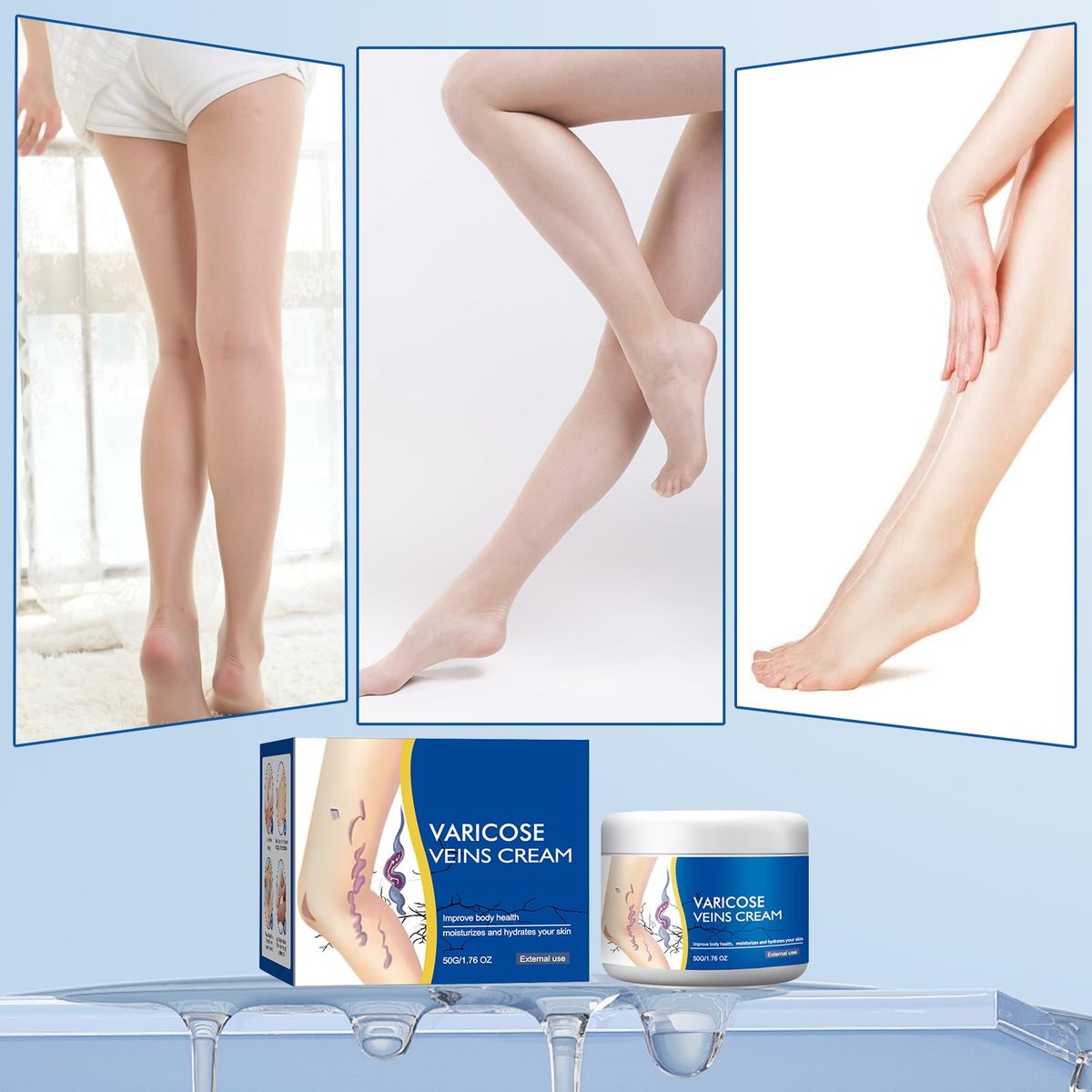 Wanban Varicose Veins Treatment Cream for Legs – Natural Ingredients, Suitable for Most Skin Types Avelisse