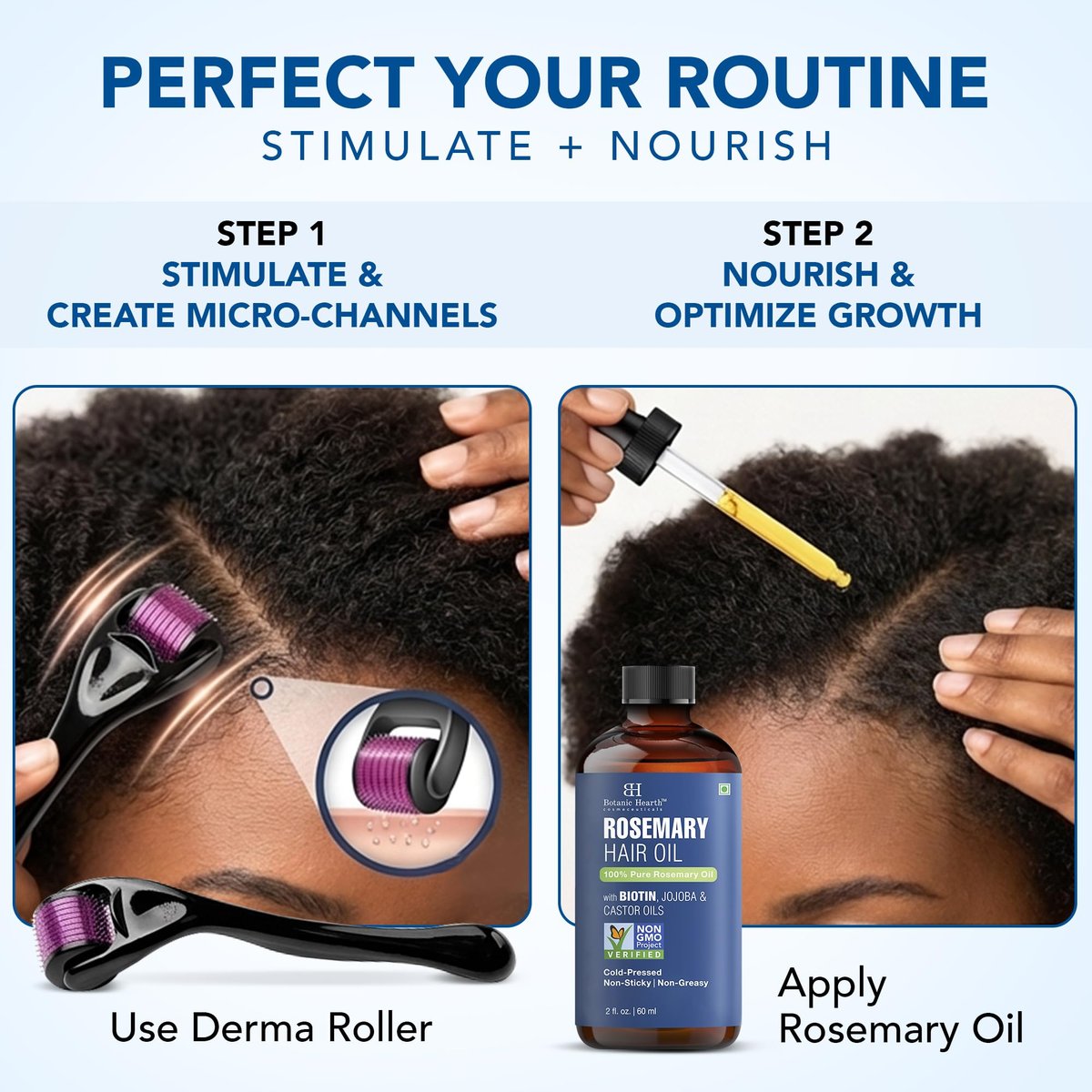 Botanic Hearth Derma Roller for Hair Growth with Rosemary Hair Oil (2 oz) – Microneedling Roller for Scalp, Beard & Face – for Women & Men – Includes Biotin, Jojoba & Castor Oil Avelisse