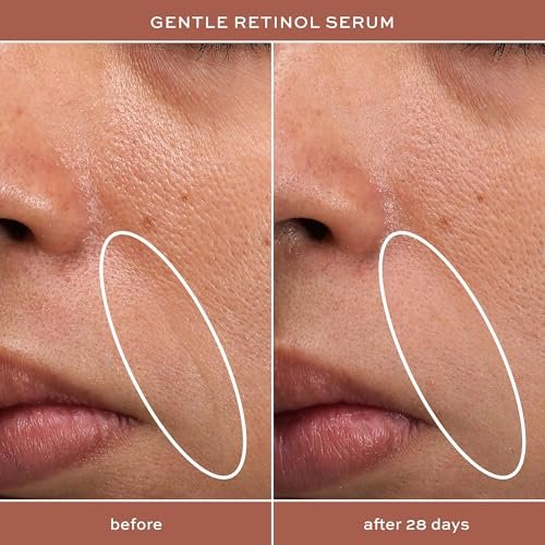 ITK Skincare Gentle Hydrating Nightly Retinol Facial Serum for All Skin Types, 1 oz - görsel 10