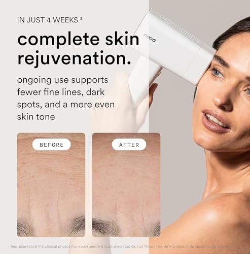 Nood Flasher Pro IPL Laser Hair Removal Device + Slow-Grow Serum for Women & Men – Gloss White Avelisse