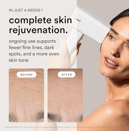 Nood Flasher Pro IPL Laser Hair Removal Device + Slow-Grow Serum for Women & Men – Gloss White Avelisse