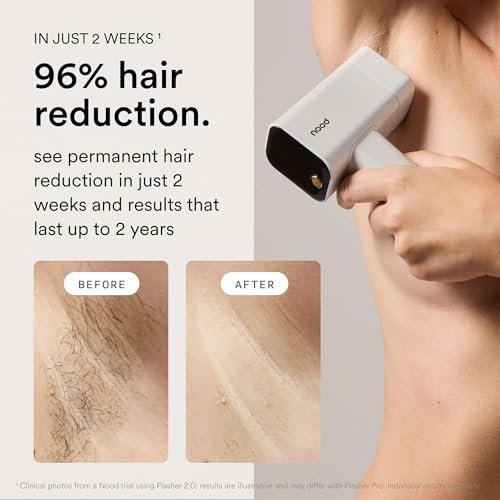 Nood Flasher Pro IPL Laser Hair Removal Device + Slow-Grow Serum for Women & Men – Gloss White Avelisse