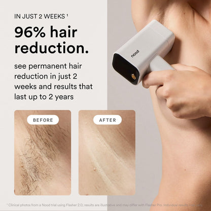 Nood Flasher Pro IPL Laser Hair Removal Device + Slow-Grow Serum for Women & Men – Gloss White Avelisse