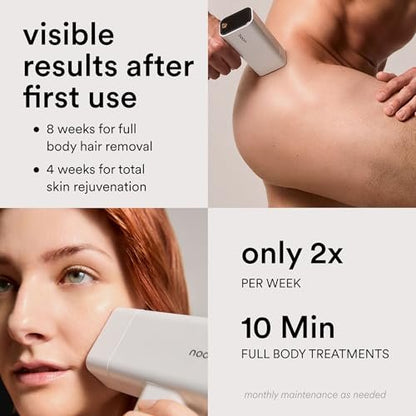 Nood Flasher Pro IPL Laser Hair Removal Device + Slow-Grow Serum for Women & Men – Gloss White Avelisse