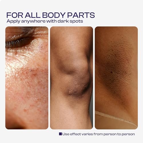 LHOPEBK Nature Dark Spot Remover for Face - Age Spot & Sun Spot Fader for Even Skin Tone, 50ml/1.71fl.oz Avelisse