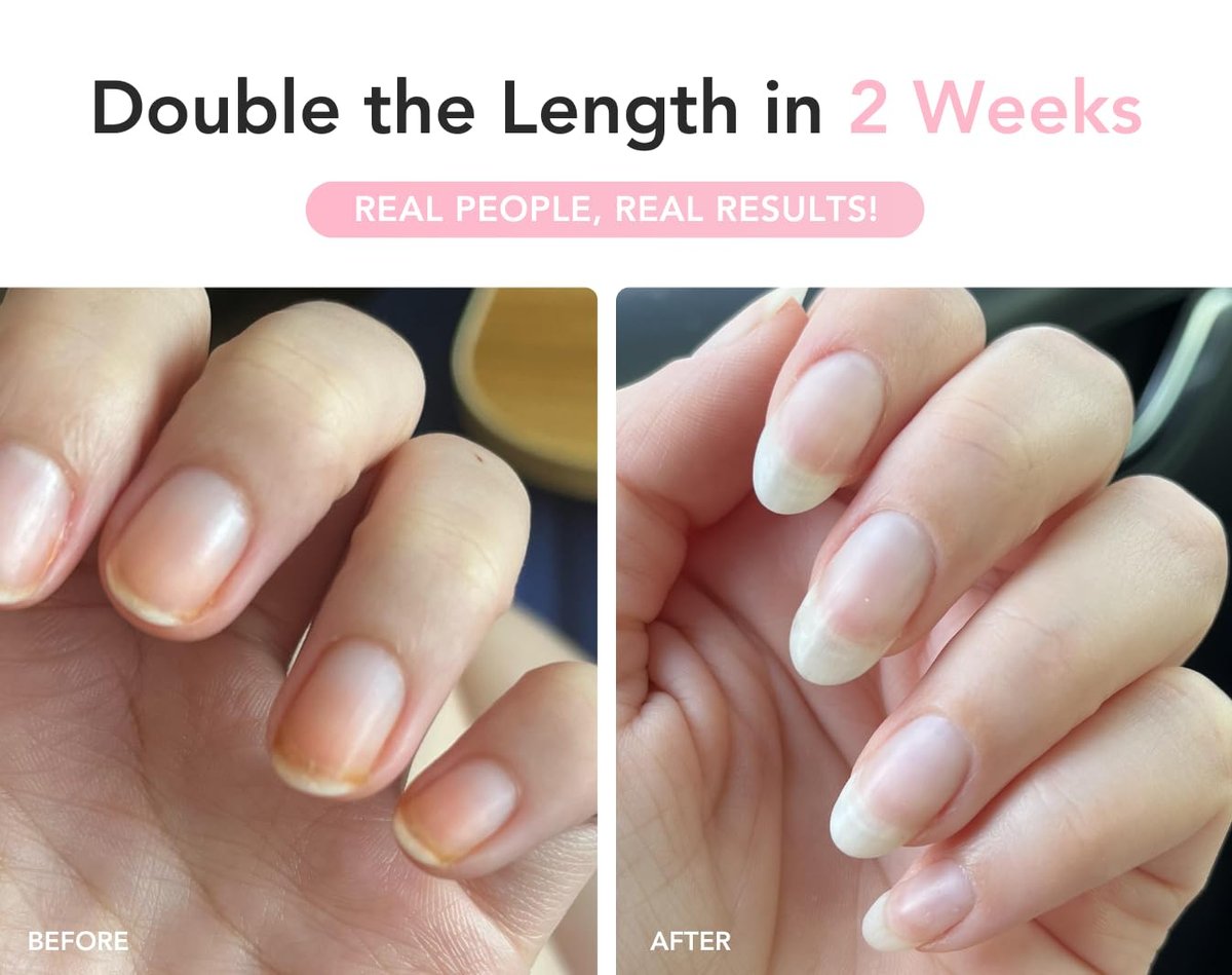 Liaison UltraGrow Nail Serum – Strengthen Weak, Brittle Nails with Keratin Complex, Olive Oil & Vitamin E | Dermatologist-Tested Avelisse