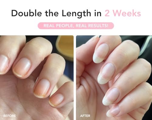 Liaison UltraGrow Nail Serum – Strengthen Weak, Brittle Nails with Keratin Complex, Olive Oil & Vitamin E | Dermatologist-Tested Avelisse