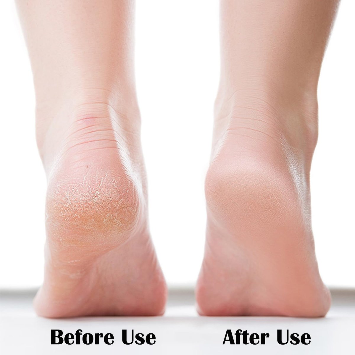 MR LION Nano Foot File - Portable Glass Callus Remover for Dead Skin, Cracked Heels, Wet & Dry Use - Transparent White, 1 Pack - görsel 5