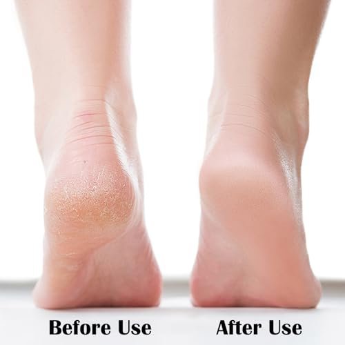 MR LION Nano Foot File - Portable Glass Callus Remover for Dead Skin, Cracked Heels, Wet & Dry Use - Transparent White, 1 Pack - görsel 6