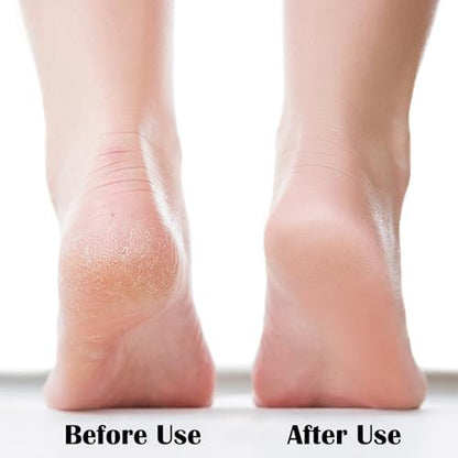 MR LION Nano Foot File - Portable Glass Callus Remover for Dead Skin, Cracked Heels, Wet & Dry Use - Transparent White, 1 Pack