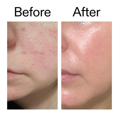 The INKEY List Exosome Hydro-Glow Complex – Advanced Hydration & Radiance Serum for All Skin Types