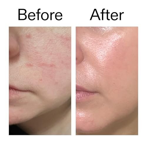 The INKEY List Exosome Hydro-Glow Complex – Advanced Hydration & Radiance Serum for All Skin Types - görsel 14