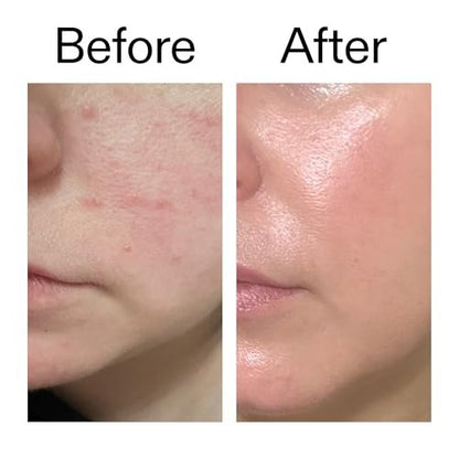 The INKEY List Exosome Hydro-Glow Complex – Advanced Hydration & Radiance Serum for All Skin Types