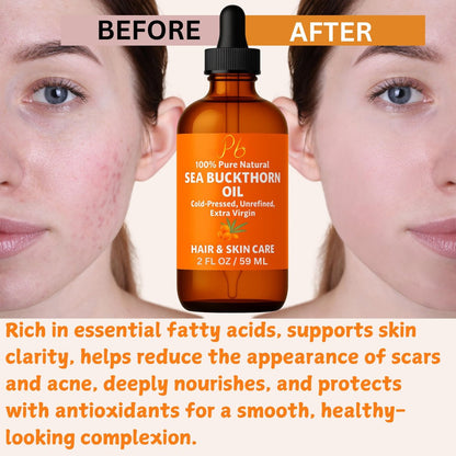 Pomberries Sea Buckthorn Oil – 100% Pure Cold-Pressed from Fruit & Seed – Face Oil for Radiant, Youthful-Looking Skin – Amber Glass Bottle 2 fl oz