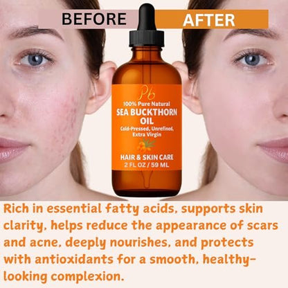 Pomberries Sea Buckthorn Oil – 100% Pure Cold-Pressed from Fruit & Seed – Face Oil for Radiant, Youthful-Looking Skin – Amber Glass Bottle 2 fl oz