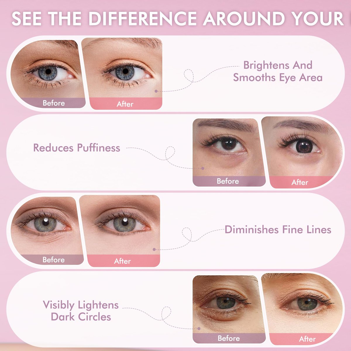 AzLucaky Rose Hydrogel Under Eye Patches – 40 Pairs, Puffy Eyes & Dark Circles Treatment with Hyaluronic Acid & Niacinamide Avelisse