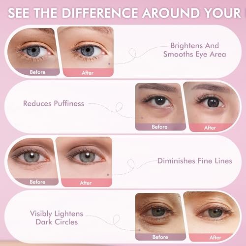 AzLucaky Rose Hydrogel Under Eye Patches – 40 Pairs, Puffy Eyes & Dark Circles Treatment with Hyaluronic Acid & Niacinamide Avelisse