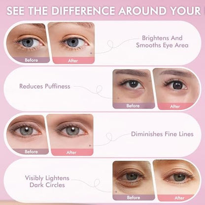 AzLucaky Rose Hydrogel Under Eye Patches – 40 Pairs, Puffy Eyes & Dark Circles Treatment with Hyaluronic Acid & Niacinamide Avelisse