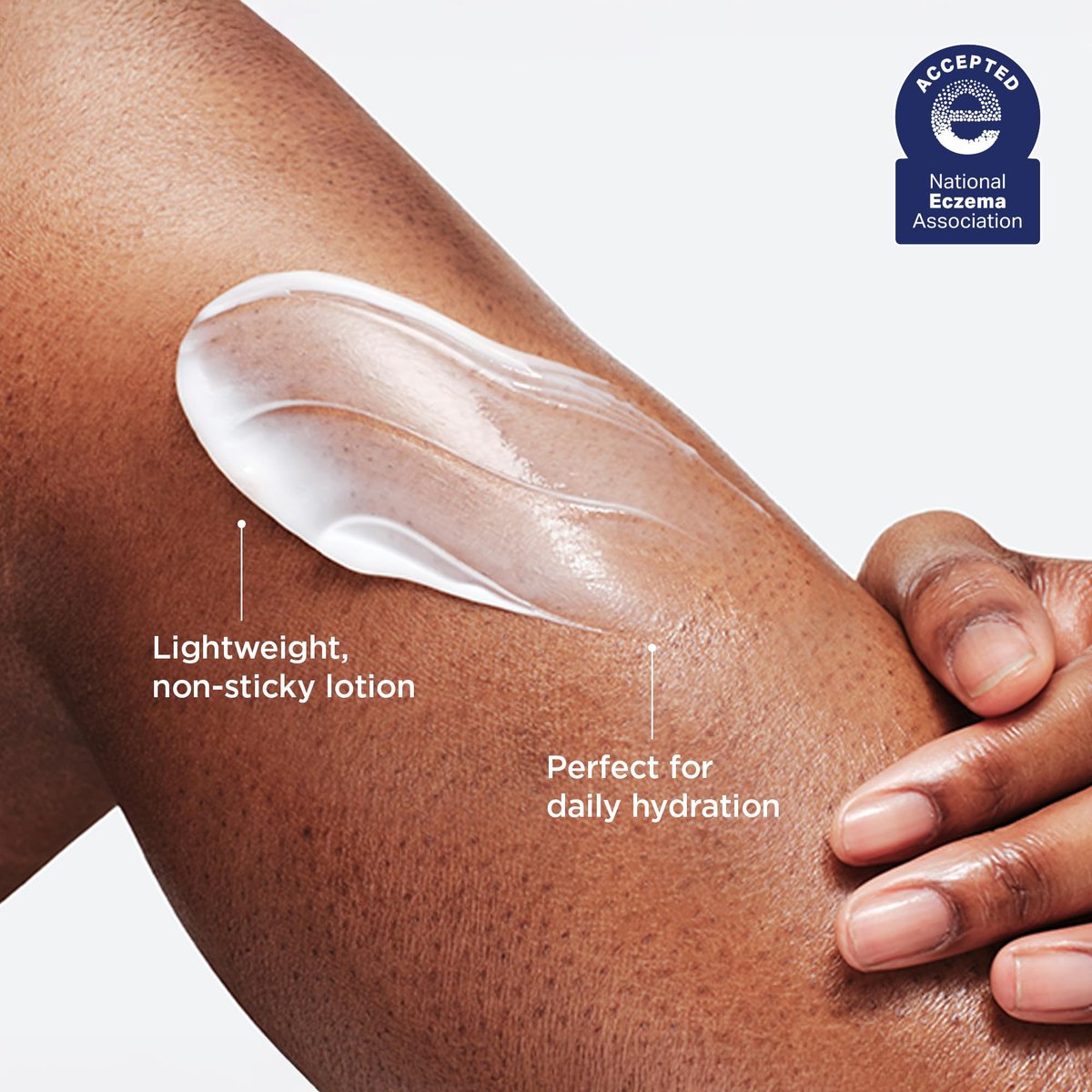 AESTURA ATOBARRIER365 Korean Body Lotion with Ceramides & Glycerin – Lightweight Hydrating Moisturizer for Dry, Sensitive & Eczema-Prone Skin – Fragrance-Free, 400 mL Avelisse
