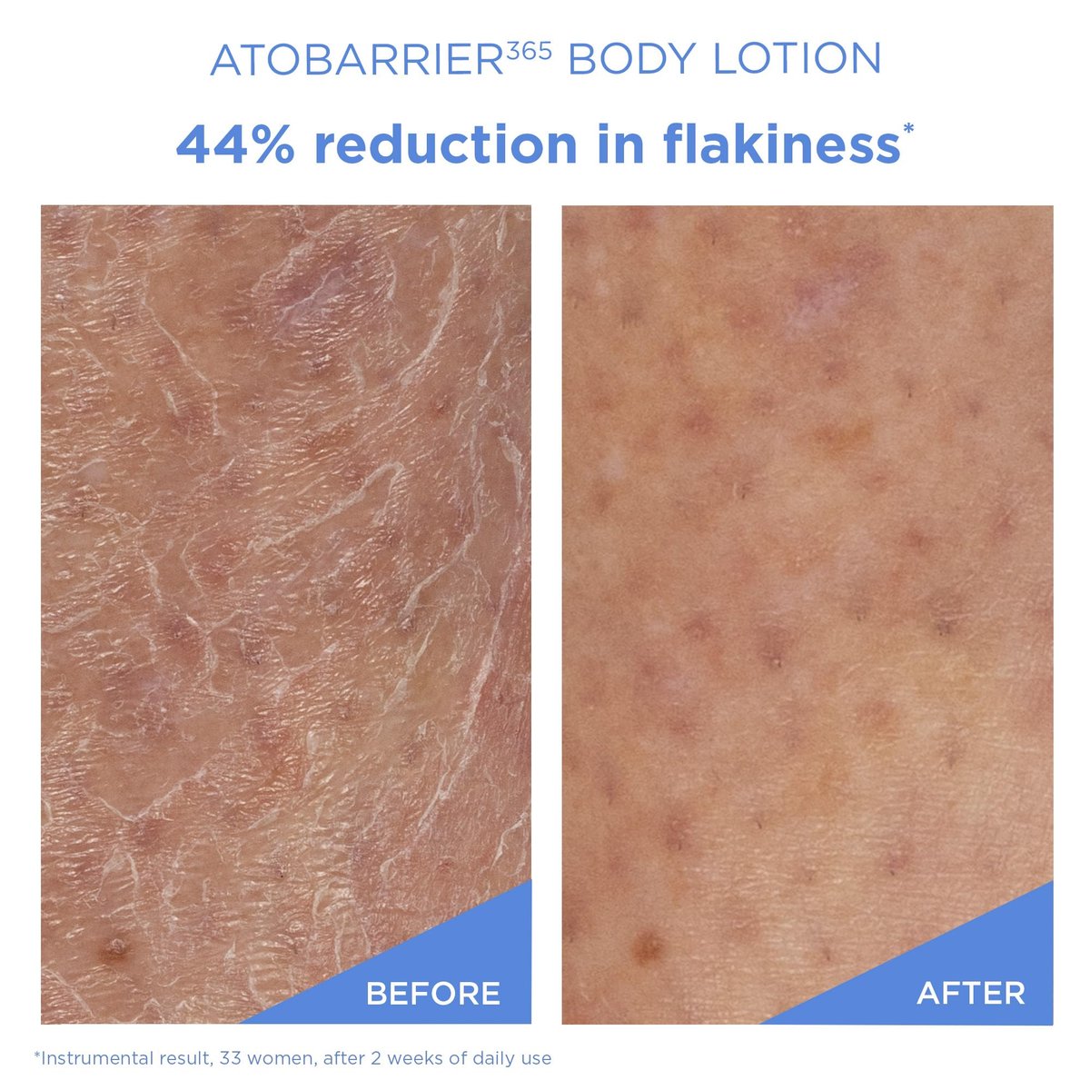AESTURA ATOBARRIER365 Korean Body Lotion with Ceramides & Glycerin – Lightweight Hydrating Moisturizer for Dry, Sensitive & Eczema-Prone Skin – Fragrance-Free, 400 mL Avelisse