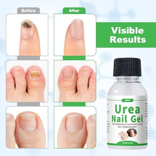 ZOXY Urea Nail Gel 40% – Softens Thick Nails & Calluses, Restores Discolored & Damaged Nails, Fast-Absorbing Nail Treatment, 1 Fl Oz Avelisse