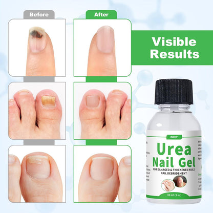 ZOXY Urea Nail Gel 40% – Softens Thick Nails & Calluses, Restores Discolored & Damaged Nails, Fast-Absorbing Nail Treatment, 1 Fl Oz Avelisse