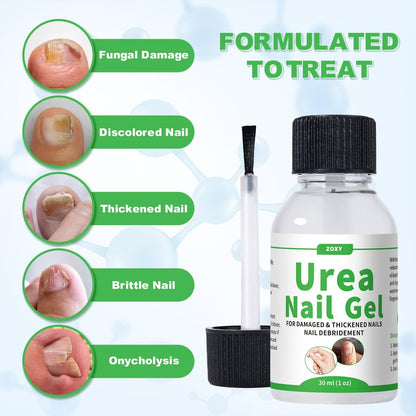ZOXY Urea Nail Gel 40% – Softens Thick Nails & Calluses, Restores Discolored & Damaged Nails, Fast-Absorbing Nail Treatment, 1 Fl Oz Avelisse