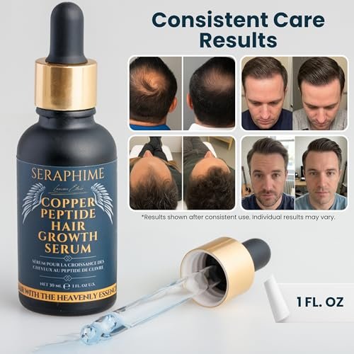 Seraphime Copper Peptide Serum for Hair Growth - Caffeine, Niacinamide, Rosemary Oil, Saw Palmetto Hair Density Serum, Topical Tripeptide Scalp Care for Hair Thinning, Women & Men 1 fl oz Avelisse