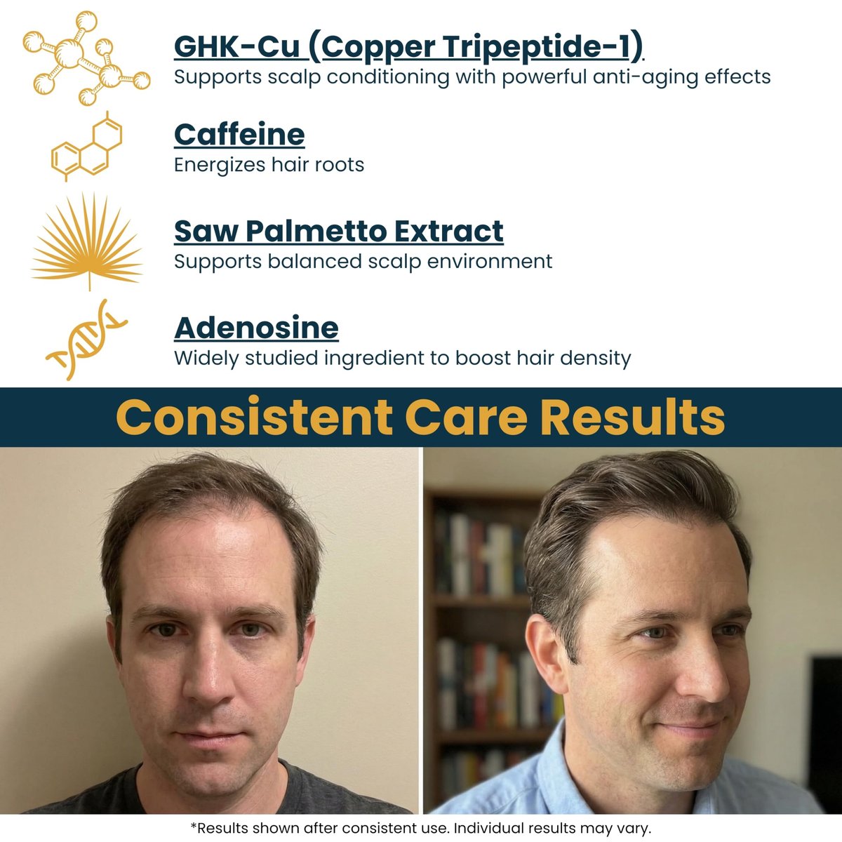 Seraphime Copper Peptide Serum for Hair Growth - Caffeine, Niacinamide, Rosemary Oil, Saw Palmetto Hair Density Serum, Topical Tripeptide Scalp Care for Hair Thinning, Women & Men 1 fl oz Avelisse