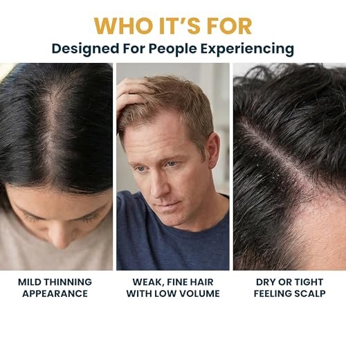 Seraphime Copper Peptide Serum for Hair Growth - Caffeine, Niacinamide, Rosemary Oil, Saw Palmetto Hair Density Serum, Topical Tripeptide Scalp Care for Hair Thinning, Women & Men 1 fl oz Avelisse