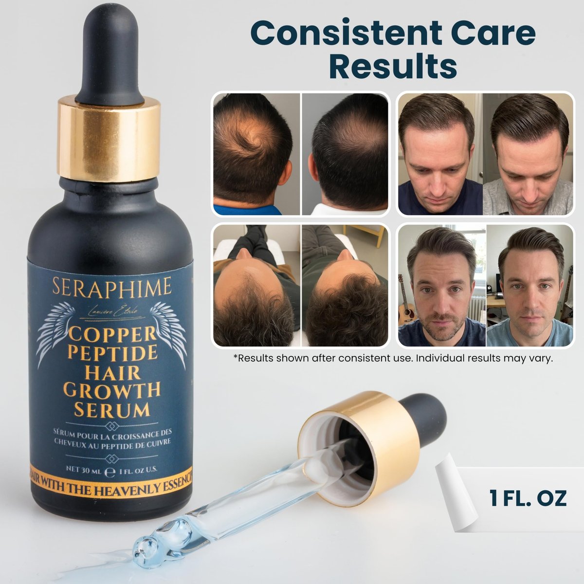 Seraphime Copper Peptide Serum for Hair Growth - Caffeine, Niacinamide, Rosemary Oil, Saw Palmetto Hair Density Serum, Topical Tripeptide Scalp Care for Hair Thinning, Women & Men 1 fl oz Avelisse