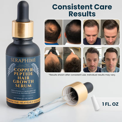 Seraphime Copper Peptide Serum for Hair Growth - Caffeine, Niacinamide, Rosemary Oil, Saw Palmetto Hair Density Serum, Topical Tripeptide Scalp Care for Hair Thinning, Women & Men 1 fl oz Avelisse