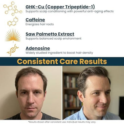 Seraphime Copper Peptide Serum for Hair Growth - Caffeine, Niacinamide, Rosemary Oil, Saw Palmetto Hair Density Serum, Topical Tripeptide Scalp Care for Hair Thinning, Women & Men 1 fl oz Avelisse